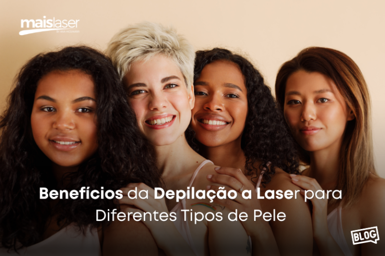 Benefícios da depilação a laser